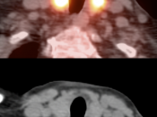Case 3 (Image 2)