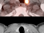 Case 4 (Image 2)