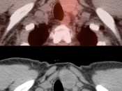Case 5 (Image 2)
