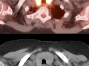 Case 7 (Image 2)