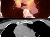 Case 12 (Image 2)