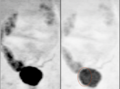 Case 2 (Image 2)
