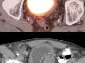 Case 3 (Image 2)