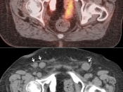 Case 5 (Image 2)