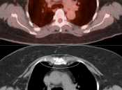 Case 2 (Image 2)