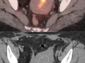 Case 2 (Image 2)