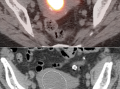 Case 3 (Image 2)