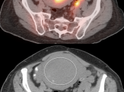Case 5 (Image 2)