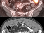 Case 6 (Image 2)