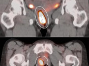 Case 2 (Image 2)