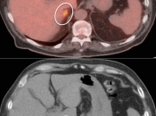 Case 4 (Image 2)