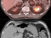 Case 6 (Image 2)