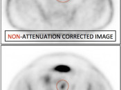 Figure 10 (Image 2) PET/CT Scan