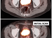 Case 4 (Image 2)