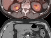 Case 1 (Image 2)