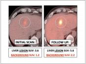 Figure 1 (Image 2) comparing suvs