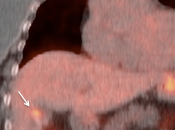 Case 6 (Image 2)