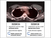 Figure 1 (Image 2) patient 1 and patient 2 scans