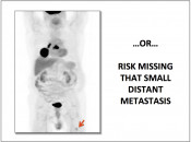Figure 4 (Image 2) PET/CT Scan