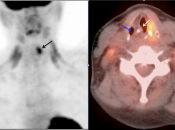 Case 2 (Image 2)