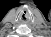 Case 3 (Image 2)
