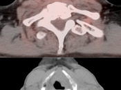 Case 4 (Image 2)