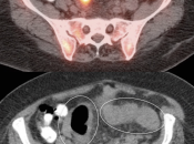 Case 2 (Image 2)