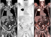 Case 6 (Image 2)