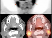 Case 1 (Image 2)