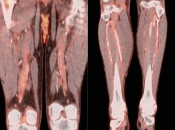 Case 2 (Image 2)