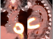 Case 4 (Image 2)