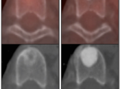 Case 1 (Image 2)
