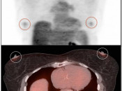 Case 5 (Image 2)