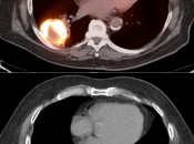 Case 1 (Image 2)