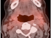 Case 3 (Image 2)