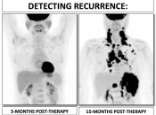 Figure 4 (Image 2) detecting recurrence
