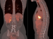 Case 1 (Image 2)
