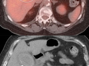 Case 4 (Image 2)