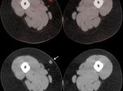 Case 1 (Image 2)