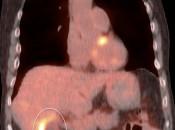 Case 5 (Image 2)