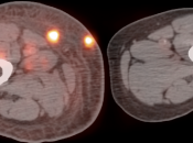 Case 3 (Image 2)