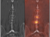 Case 2 (Image 3)