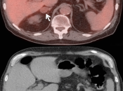 Case 2 (Image 3)