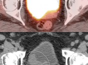 Case 2 (Image 3)