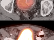 Case 3 (Image 3)