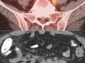 Case 5 (Image 3)