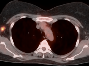 Case 4 (Image 3)