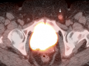 Case 4 (Image 3)