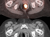 Case 1 (Image 3)