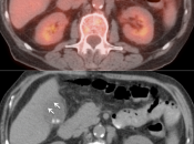 Case 5 (Image 3)
